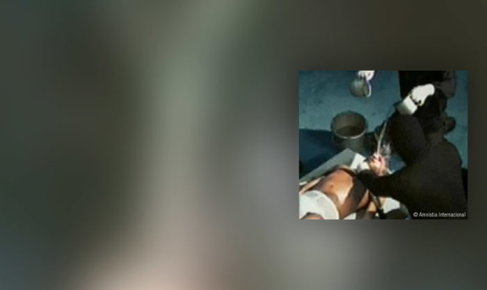 EUA devem aproveitar avaliação nas Nações Unidas para explicar as falhas do país sobre a tortura
