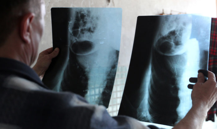 Provas incontornáveis de prisioneiros torturados e executados sumariamente no conflito na Ucrânia